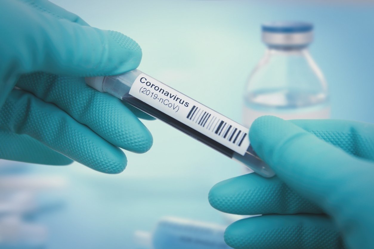 Украинские ученые завершили создание тестов на коронавирус