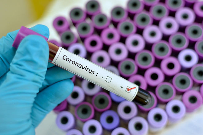Аналитики подсчитали, сколько будет стоить вакцина от COVID