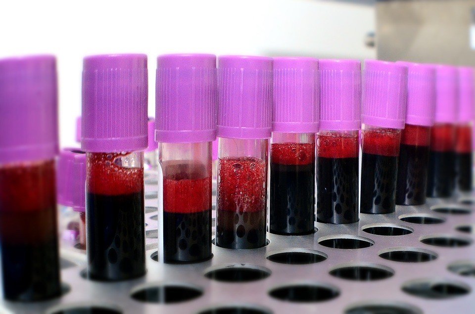 У людей з сепсисом в крові знайшли невідомі частинки