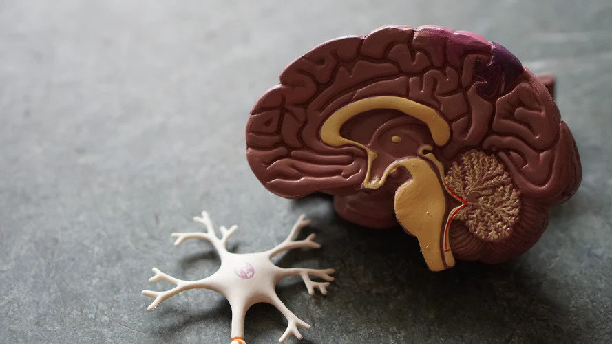 Чому вчені відмовляються від сканування мозку