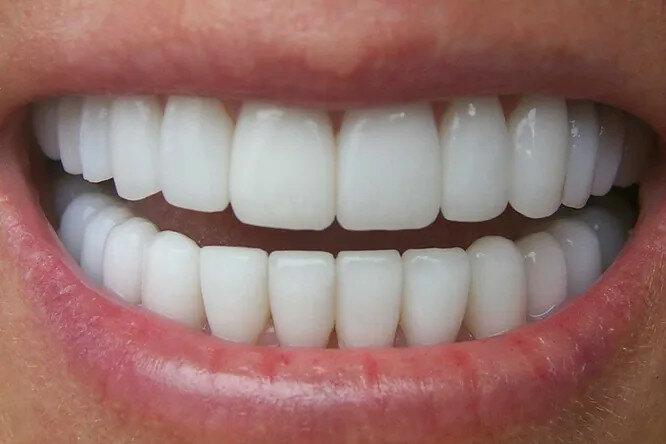 Кінець пломбам: науковий спосіб змусити зуби рости