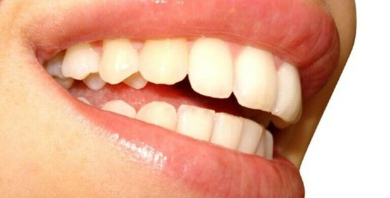 Ученые нашли способ восстановить выпавшие зубы