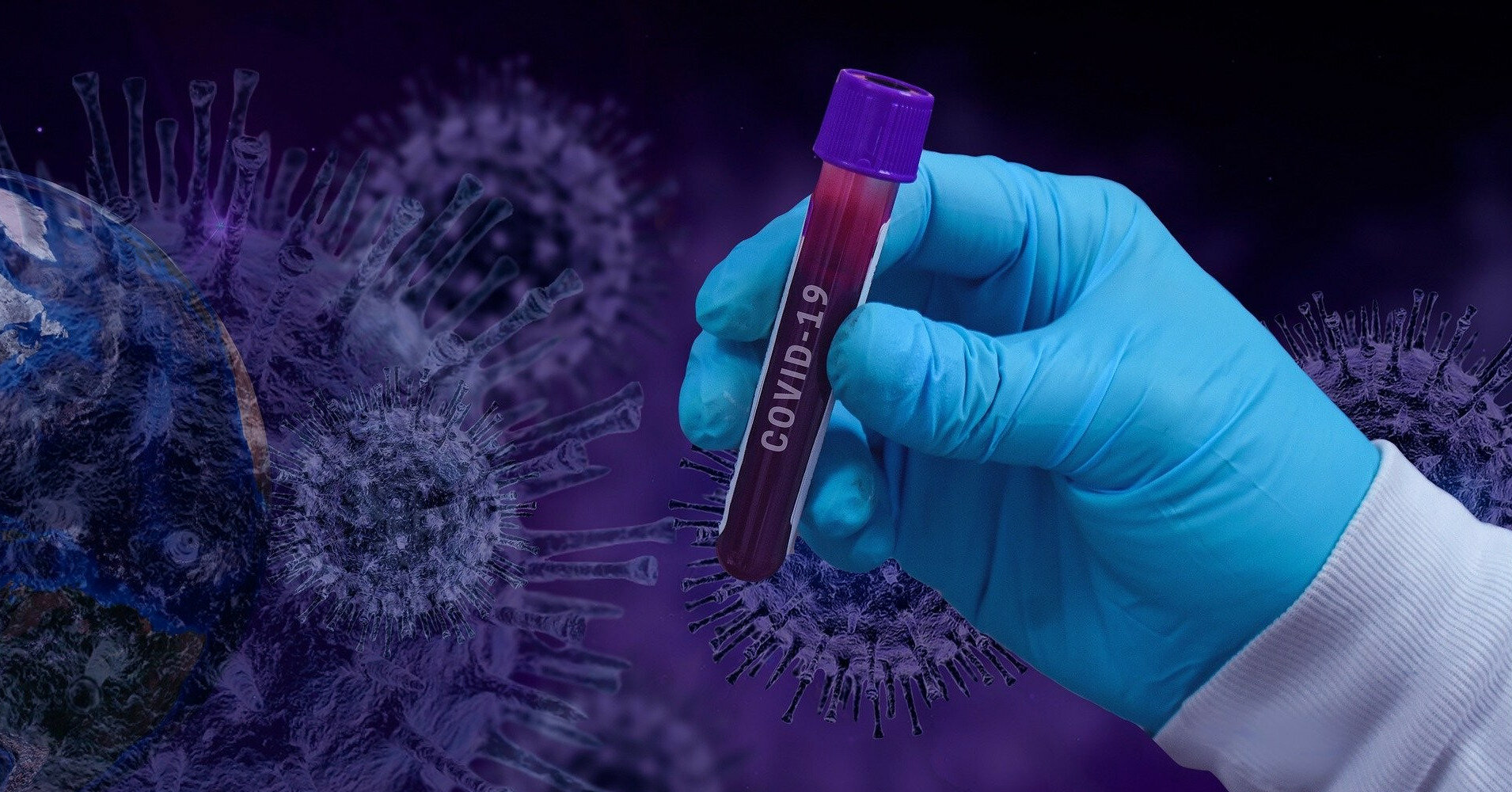 В мире зафиксировали новый рекорд смертности от коронавируса