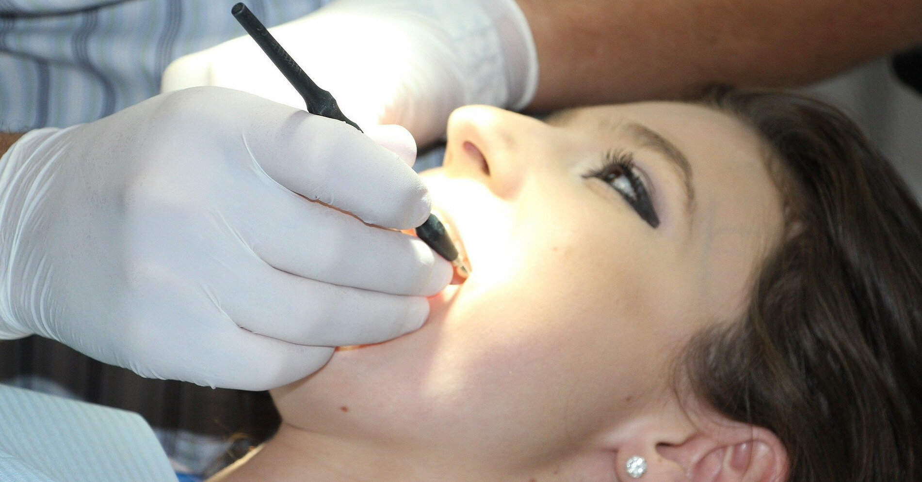Склад слини впливає на утворення зубного каменю — стоматолог