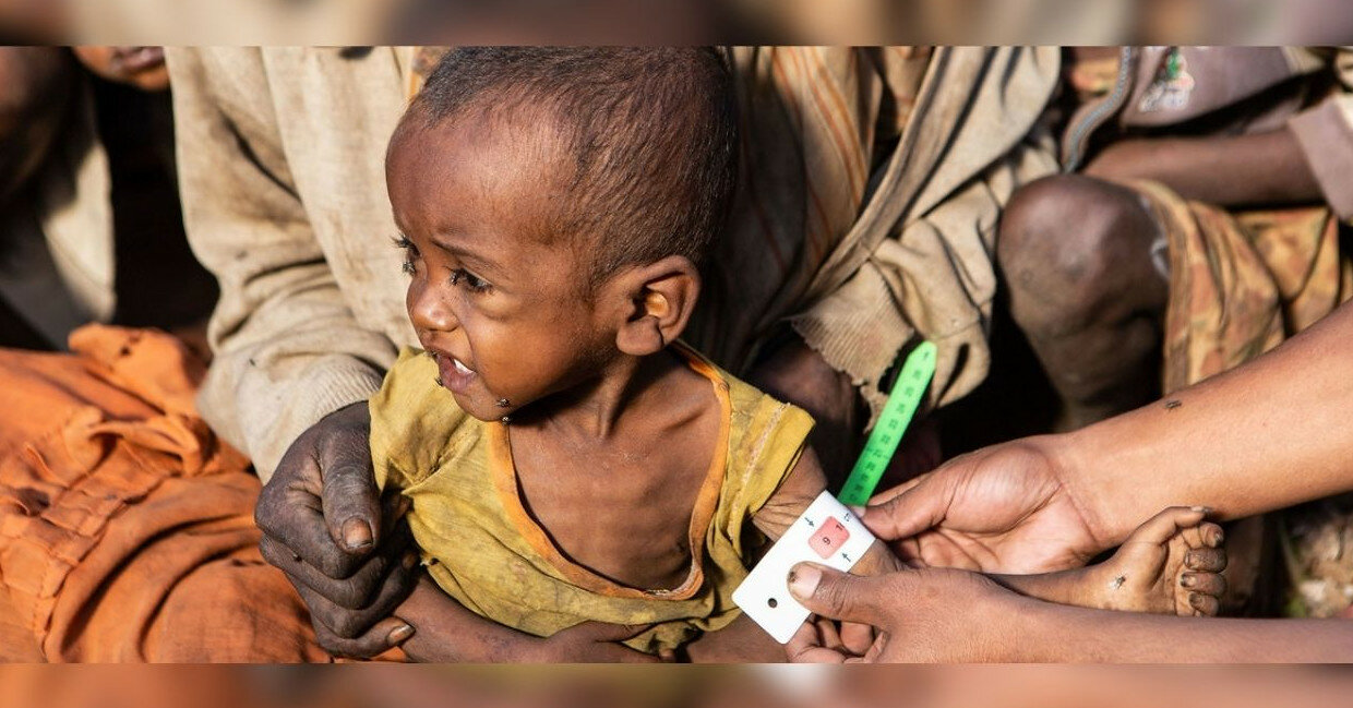 В ООН заявили о голоде на Мадагаскаре